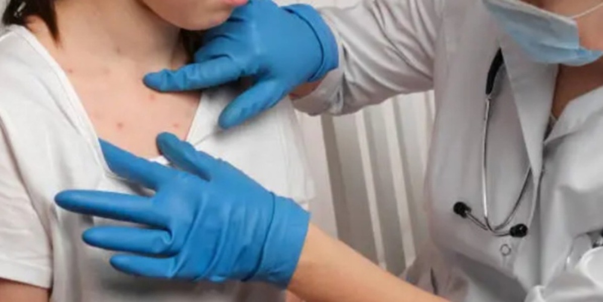 Oaxaca y Guerrero Unen Fuerzas en Estrategia Innovadora contra el Sarampión